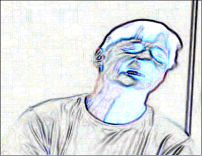 Torticollis, zervikale Dystonie, Therapie, Behandlung